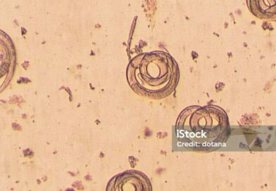 Трихинеллез. Как избежать заражения?